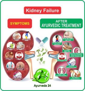 Ayurvedic Medicine for Kidney Failure