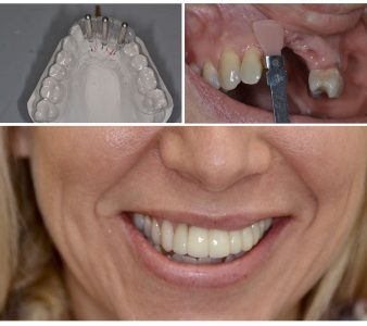 Prosthodontic and Orthodontic treatment- Kannur